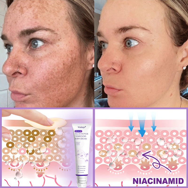 Vitalisys®🎉 PDRN Multi-Peptide Massaging Body Roller Cream- Anti-aging, Hydrating, Skin Firming & Lifting, Skin Repair, Even Tone, Acne and Dark Spot Treatment, Wart and Mole Removal, and Psoriasis Relief.