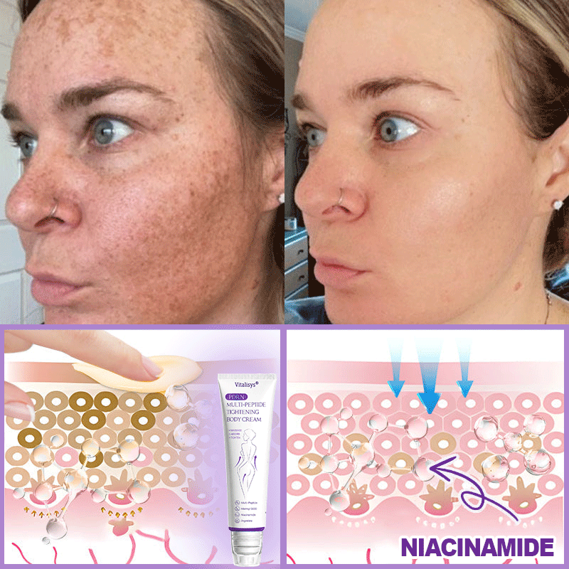 💎Vitalisys® PDRN Multi-Peptide Massaging Body Roller Cream- Anti-aging, Hydrating, Skin Firming & Lifting, Skin Repair, Even Tone, Acne and Dark Spot Treatment, Wart and Mole Removal, and Psoriasis Relief.