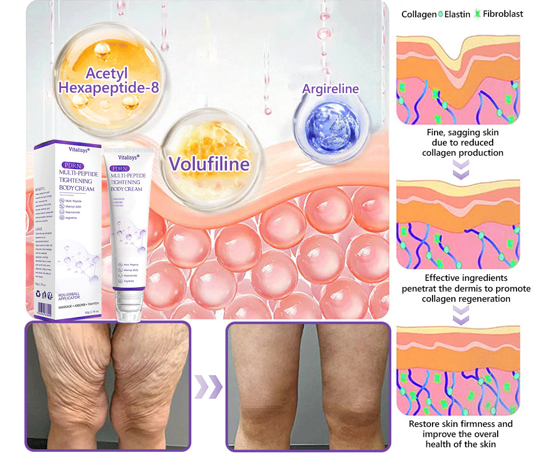 Vitalisys®🔥 PDRN Multi-Peptide Massaging Body Roller Cream- Anti-aging, Hydrating, Skin Firming & Lifting, Skin Repair, Even Tone, Acne and Dark Spot Treatment, Wart and Mole Removal, and Psoriasis Relief.